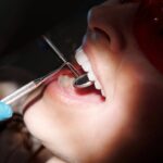 Baby-Zähne: Wann erwarten Eltern den ersten Zahn?
